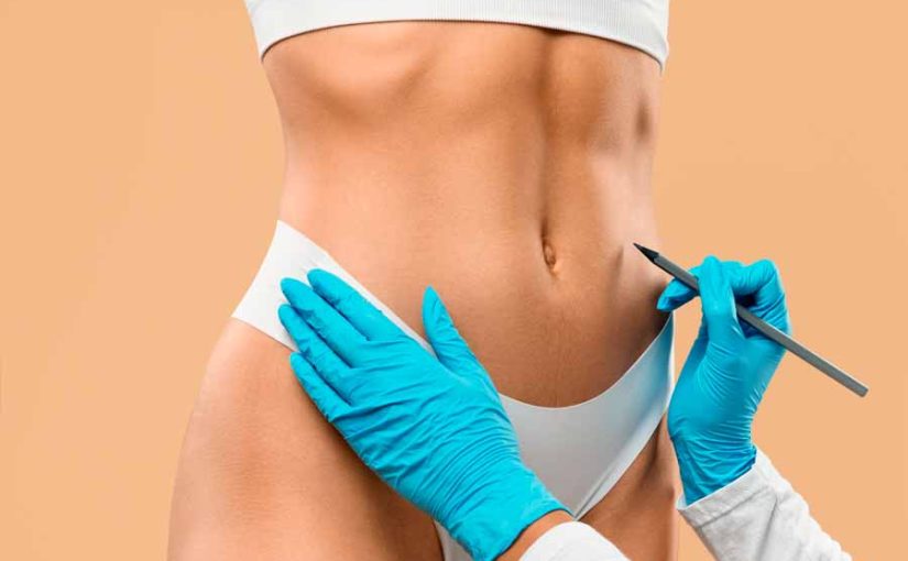 A Modernização da Cirurgia Plástica: Tecnologia e Segurança em Primeiro Lugar